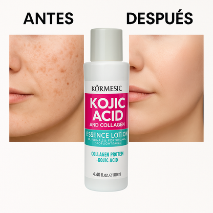 TONICO ACIDO KOJICO Y COLAGENO HIDROLIZADO
